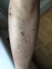 leg1.jpg