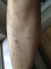 leg2.jpg