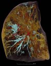 lung-covid.jpg